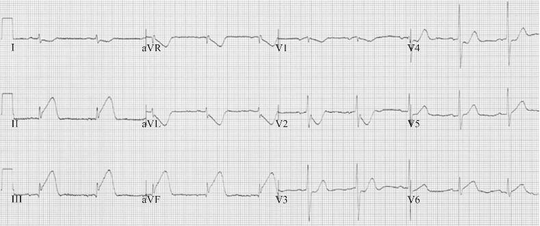 Eletrocardiograma de 12 derivações do paciente